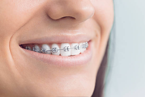 Best Teeth Whitening  in Tara Hills, CA